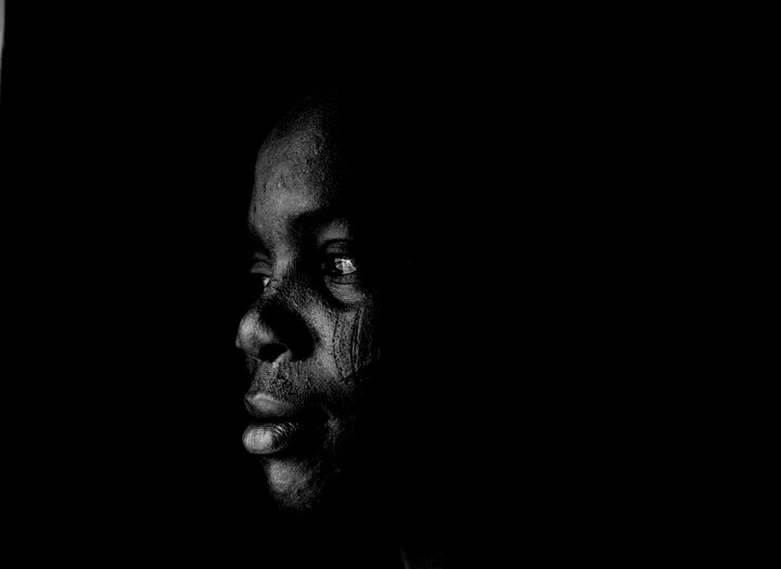 Foto do rosto de uma pessoal preta de perfil cheia de cicatrizes no rosto. A foto ilustra o artigo O tratamento psicanalítico pode apagar completamente as cicatrizes emocionais? escrito pelo psicanalista Homero Mônaco para o site Online Psicanalista. Foto de uma menina com perna levantada como se fosse pisar na lente da câmera que a fotografa. A foto ilustra o artigo 10 Maneiras Como a Terapia Psicanalítica Ajuda na Cura de Feridas Emocionais escrito pelo psicanalista Homero Mônaco para o site Online Psicanalista.
